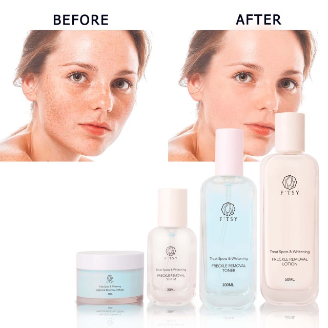 Freckle Removal Brightening Set