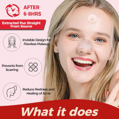Hydrocolloid Acne Patch Set