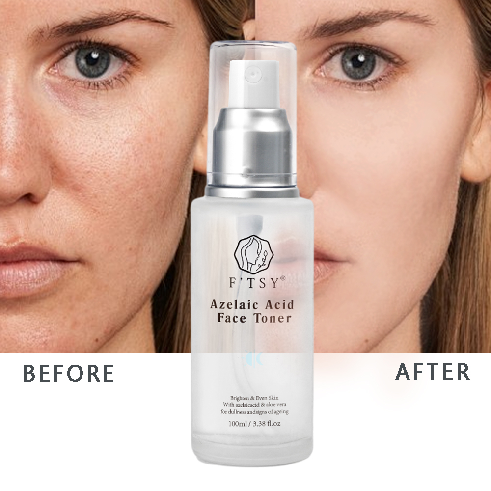 Azelaic Acid Face Toner, Even Skin & Repairing