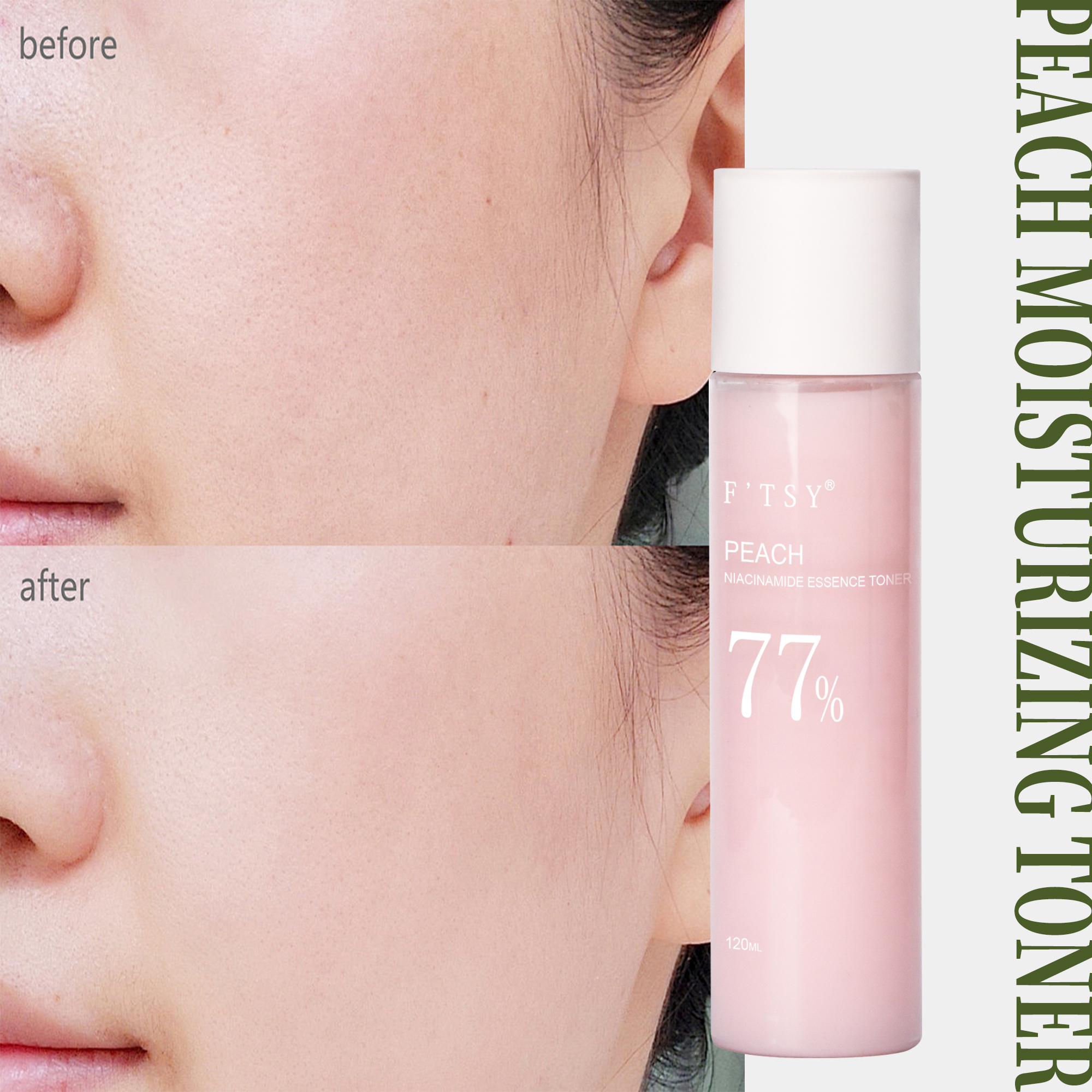 Peach Niacinamide Essence Toner