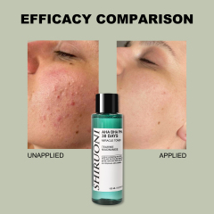 AHA BHA PHA Toner, Gentle exfoliation