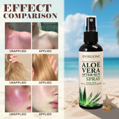 Aloe Vera After-Sun Spray