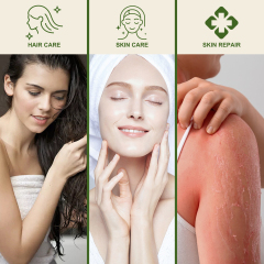 Aloe Vera After-Sun Spray