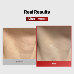 Wrinkle-Fit Neck Mask