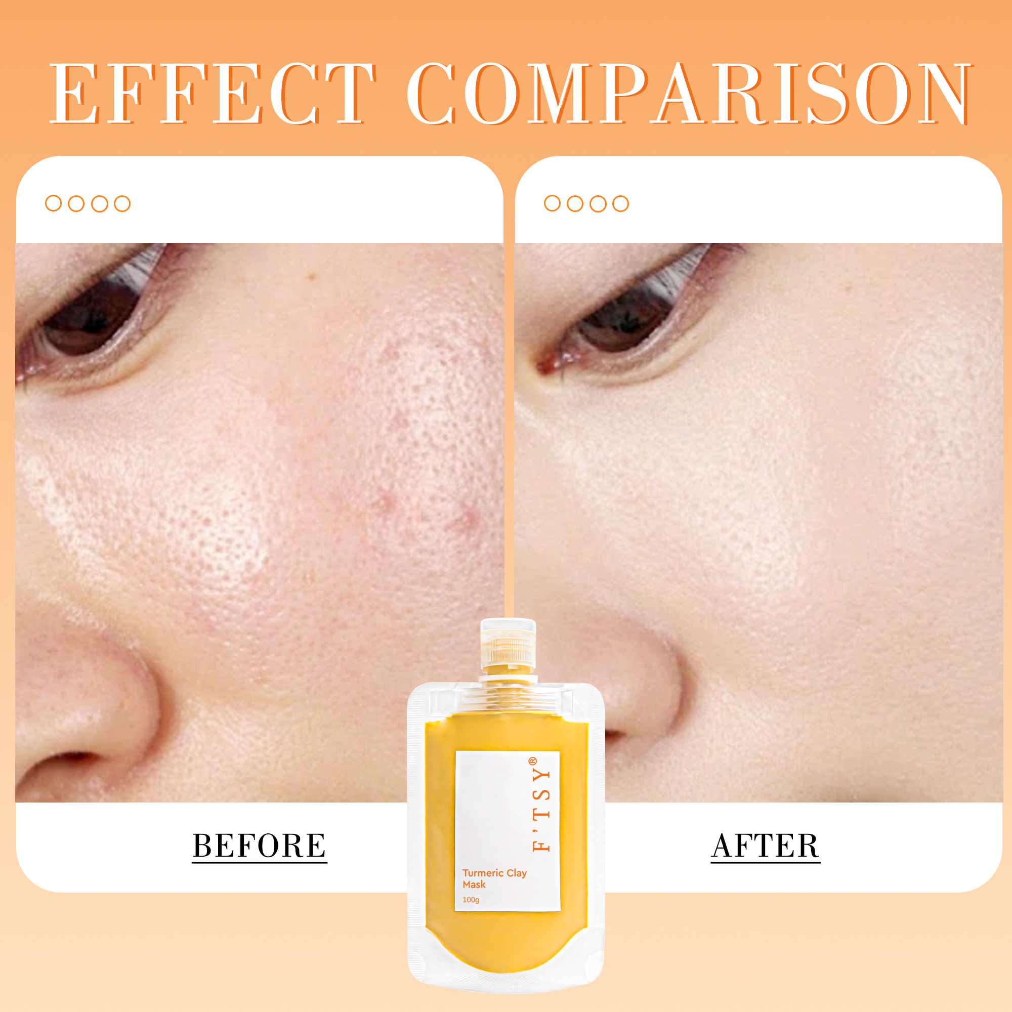 Turmeric Clay Mask, Soothing & Anti-acne
