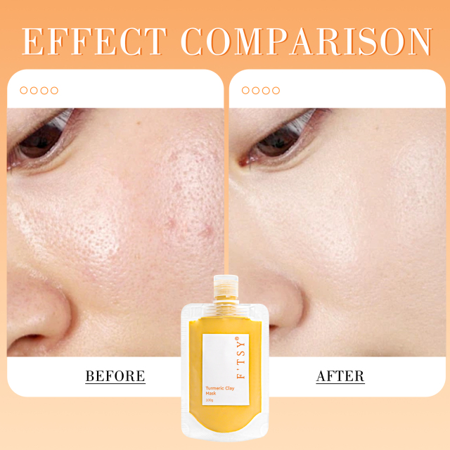 Turmeric Clay Mask, Soothing & Anti-acne