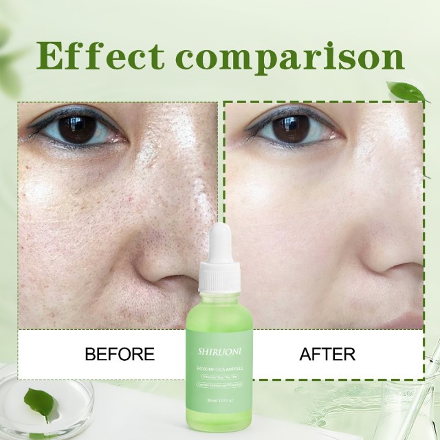 Exosome Cica Ampoule Serum