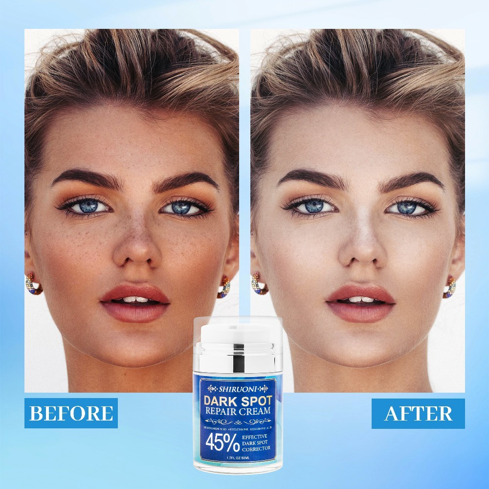 Dark Spot Repair Cream