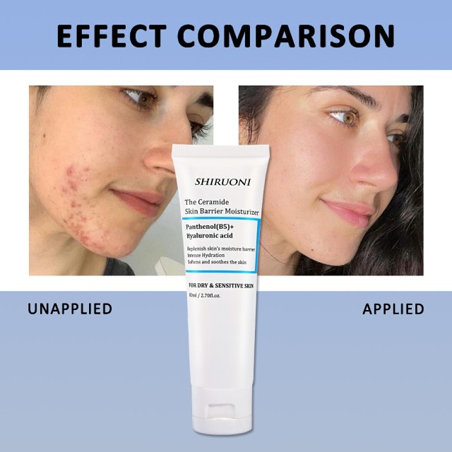 Ceramide B5 Hyaluronic Acid Moisturizer Cream