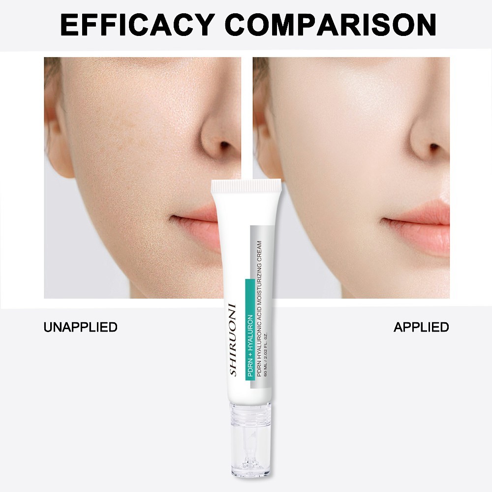 PDRN Hyaluronic Acid Moisturizer Cream