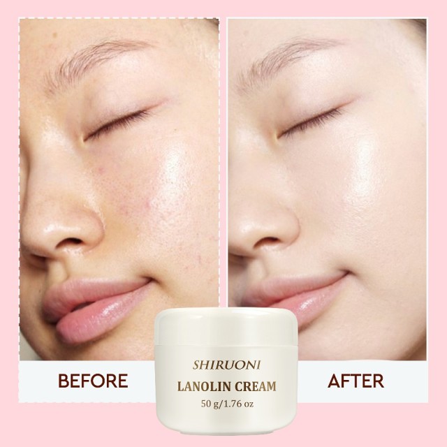 Lanolin Cream, Hydrating & Repairing