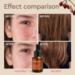 Rosehip Seed Oil, Face & Hair Care