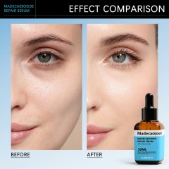 Madecassoside Repair Serum