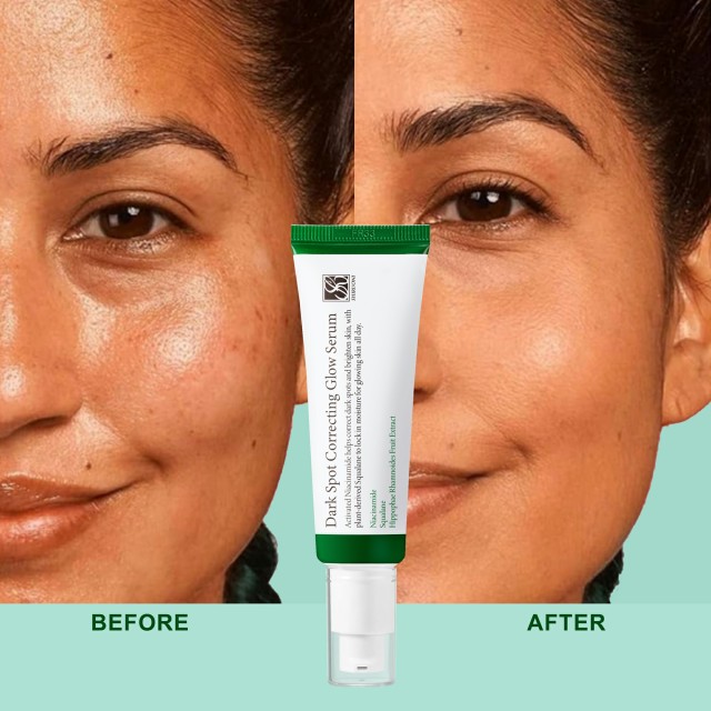 Dark Spot Correcting Serum OEM Factory for Pigmentation Care