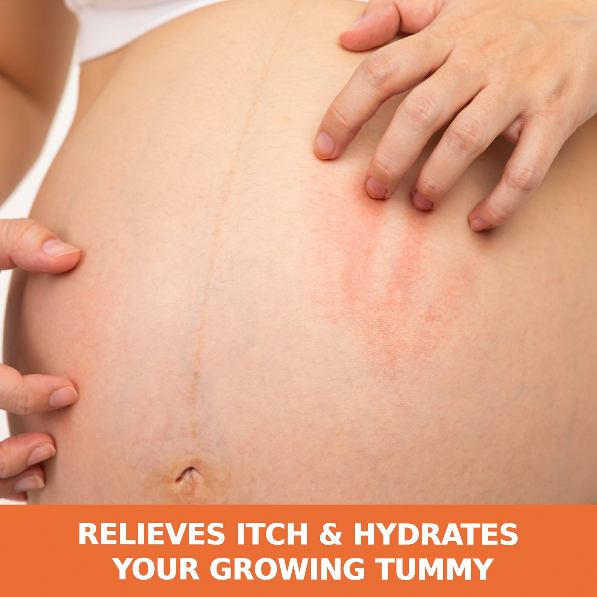 stretch mark removing oil with cocoa butter and vitamin e customize