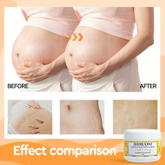 natural pregnancy skin products oem white label body cream