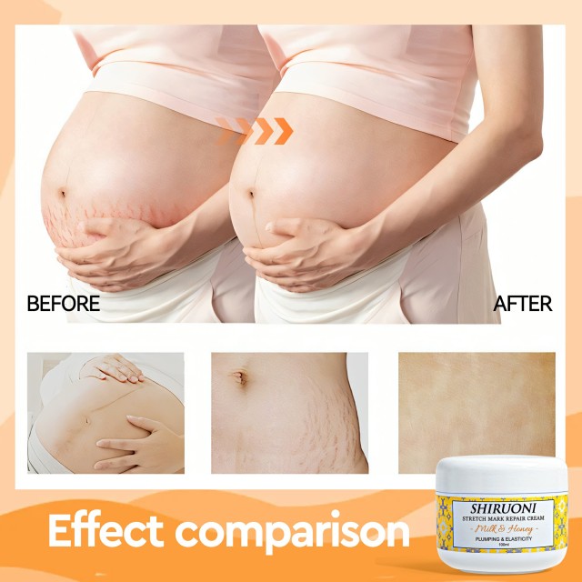 natural pregnancy skin products oem white label body cream