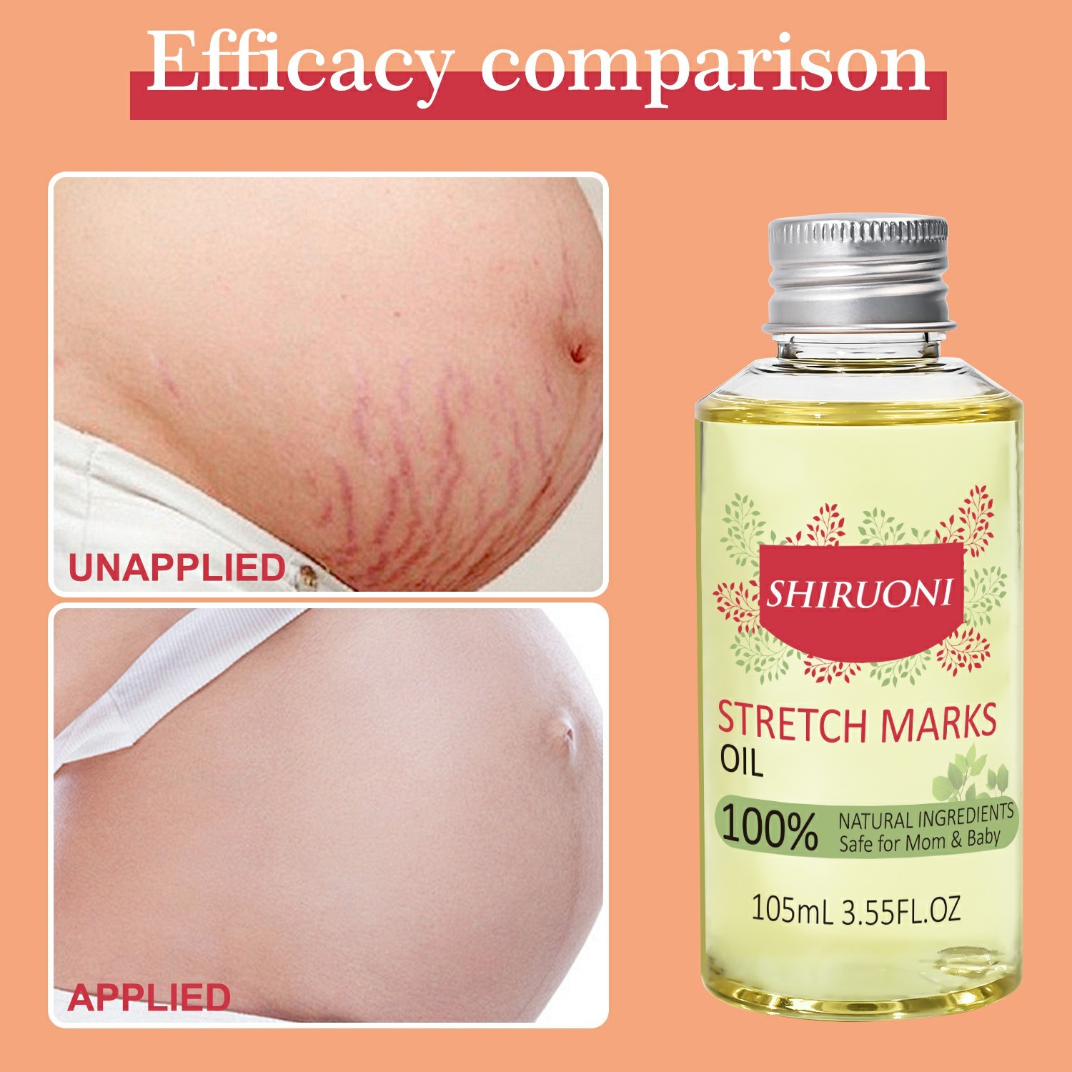 custom oem natural stretch marks body oil pregnancy safe