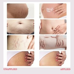 B2B Maternity Skincare Products OEM & White Label Service