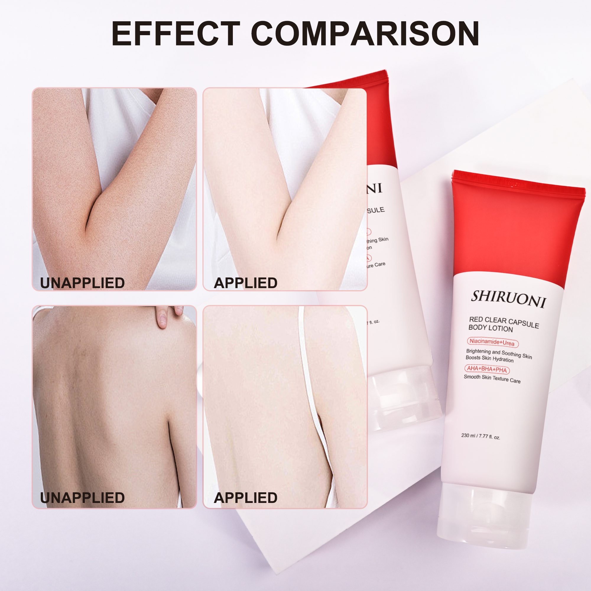 hydrating body lotion for dry skin with niacinamide and urea