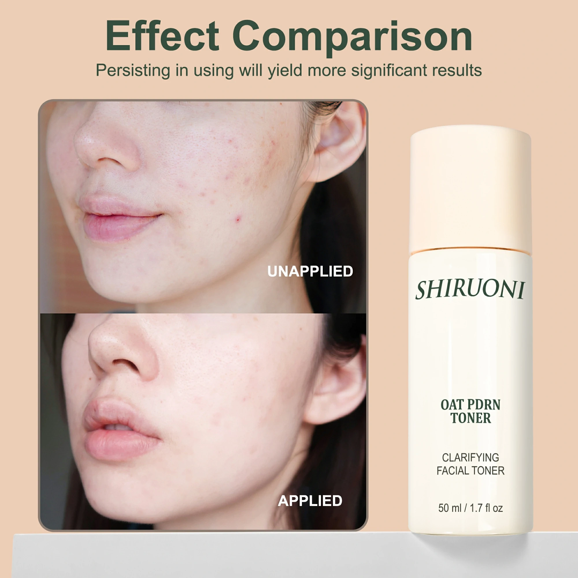 Lightweight refreshing facial toner with PDRN factory