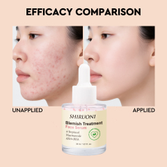 Blemish Treatment Face Serum