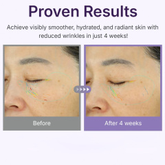 Microneedling PDRN Collagen Serum