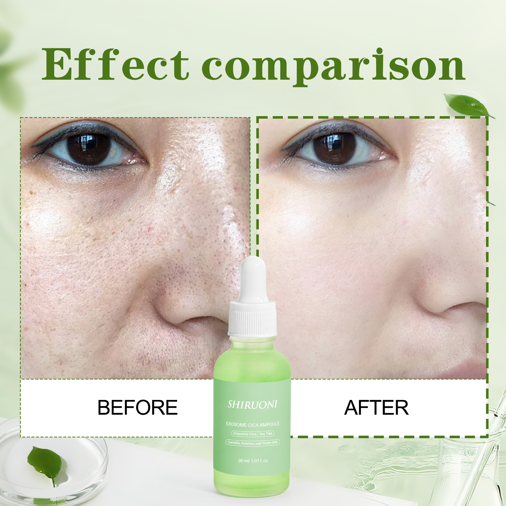 Exosome-Infused Centella Soothing & Repairing serum