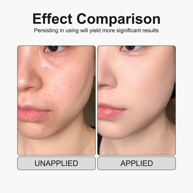 Exfoliating Serum