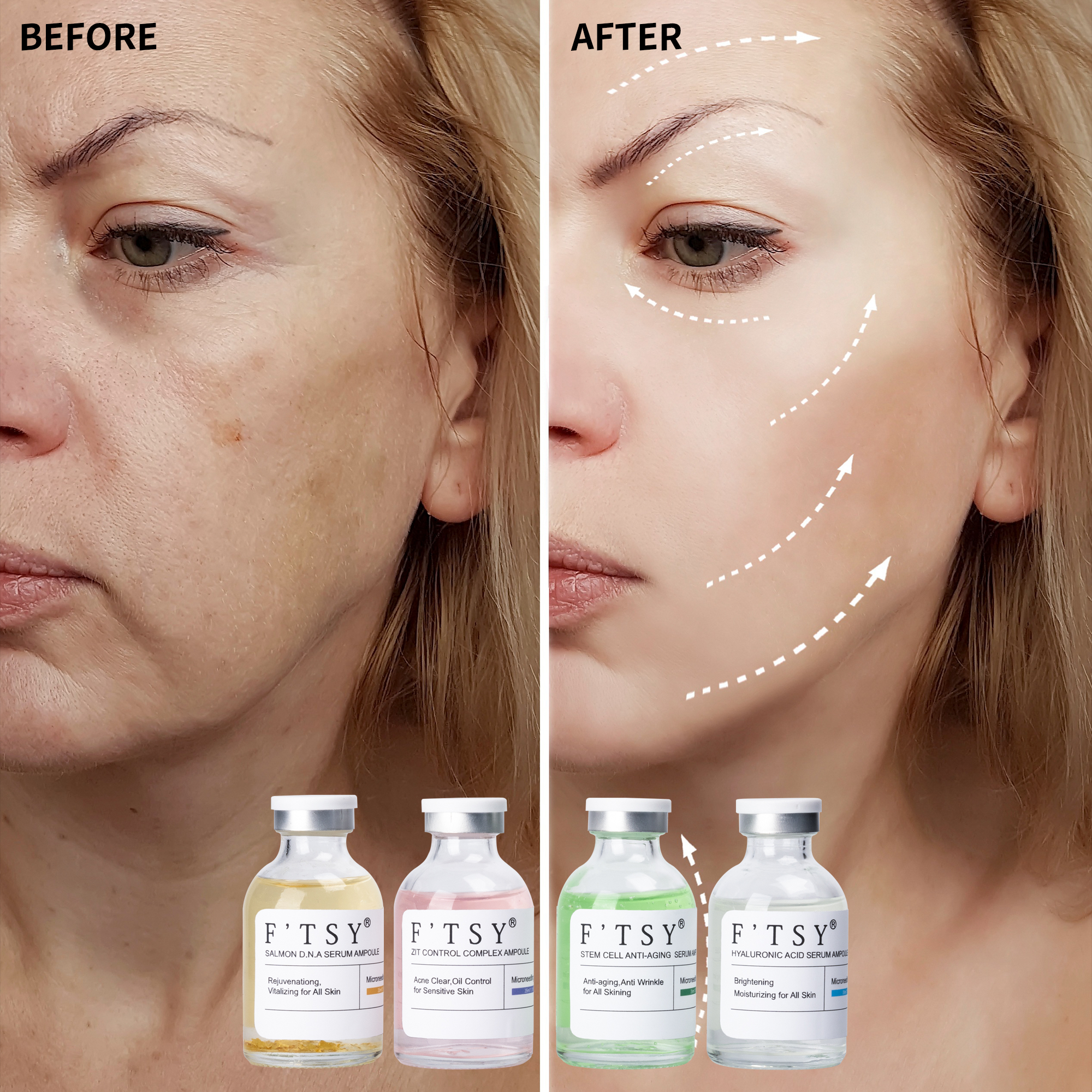 SHIRUONI Microneedling Serum Ampoule