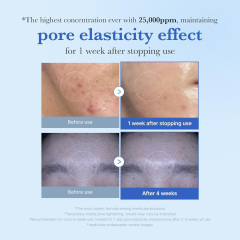 SHIRUONI Exosome Microneedling Essence