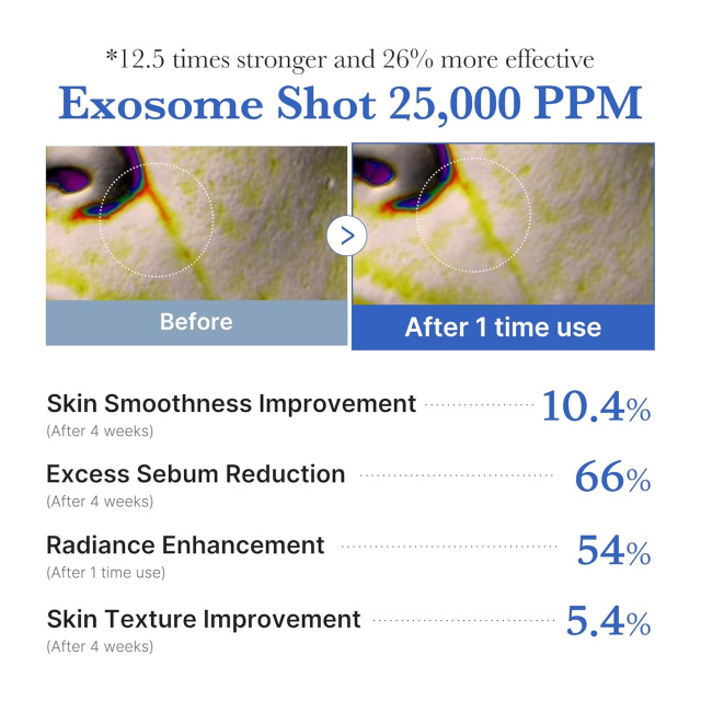 SHIRUONI Exosome Microneedling Essence