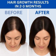 Hair Growth Copper Peptide Serum, GHK-Cu & AHK-Cu