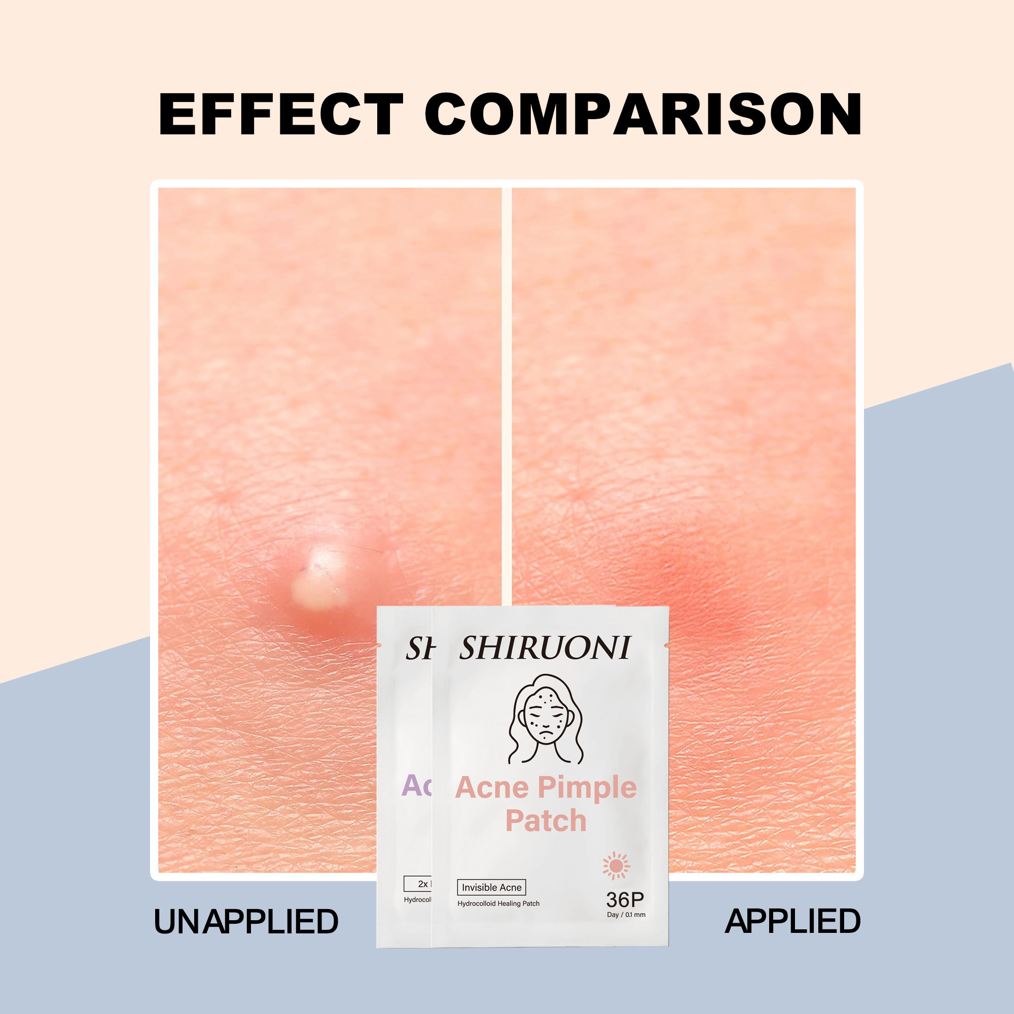 Acne Pimple Patch Day & Night