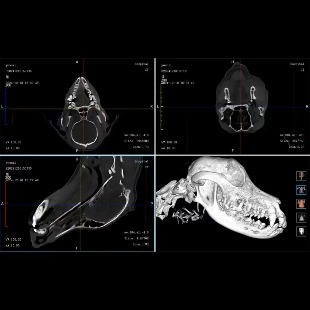 CBCT