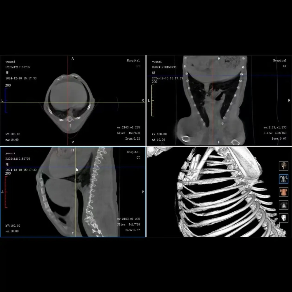 CBCT