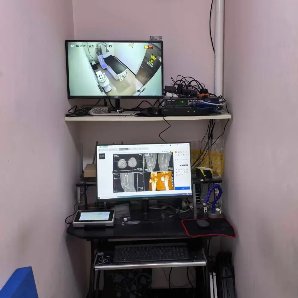 CBCT
