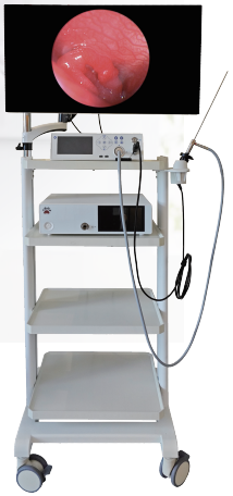 Rigid Endoscope