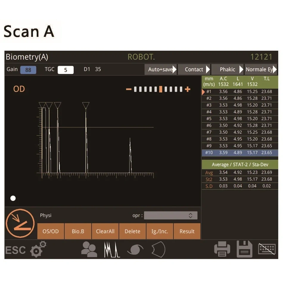 Ophthalmic Ultrasound Scanner Optical A/B Scanner AB Scan Testing Equipment Ophthalmology Device Biometry Eye Scanner