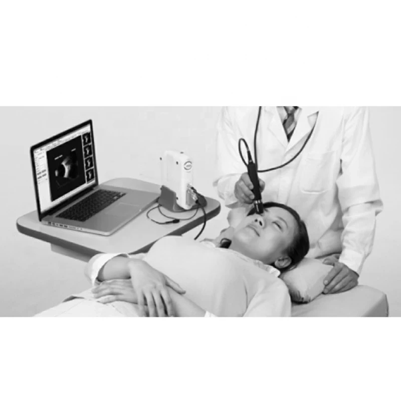 Top Quality Ophthalmic Machine AB Scan Portable Ultrasound Scanner Optical Equipment Optometry China Best Price