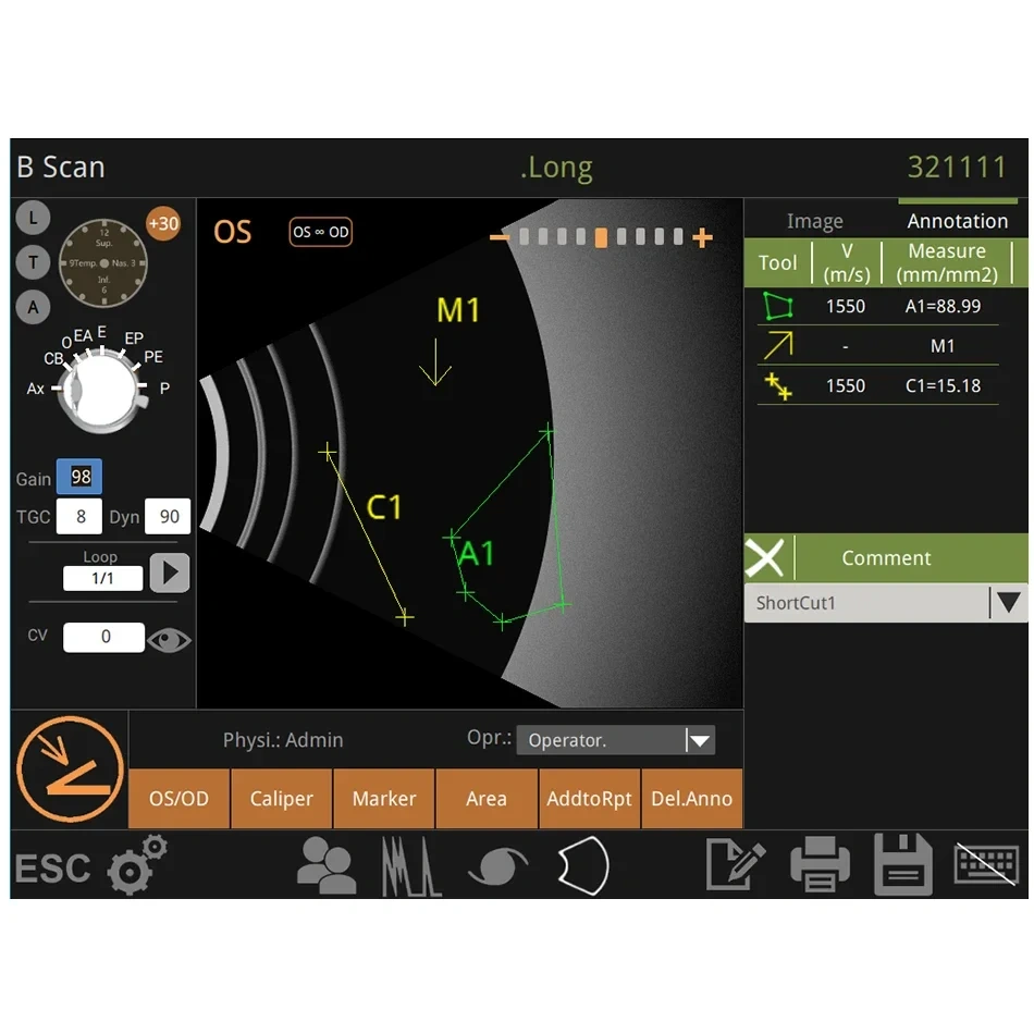 Ophthalmic Ultrasound Scanner Optical A/B Scanner AB Scan Testing Equipment Ophthalmology Device Biometry Eye Scanner
