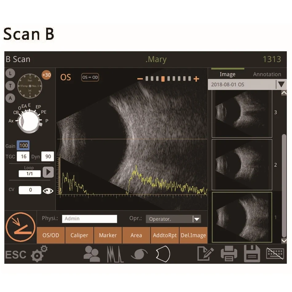 Ophthalmic Ultrasound Scanner Optical A/B Scanner AB Scan Testing Equipment Ophthalmology Device Biometry Eye Scanner
