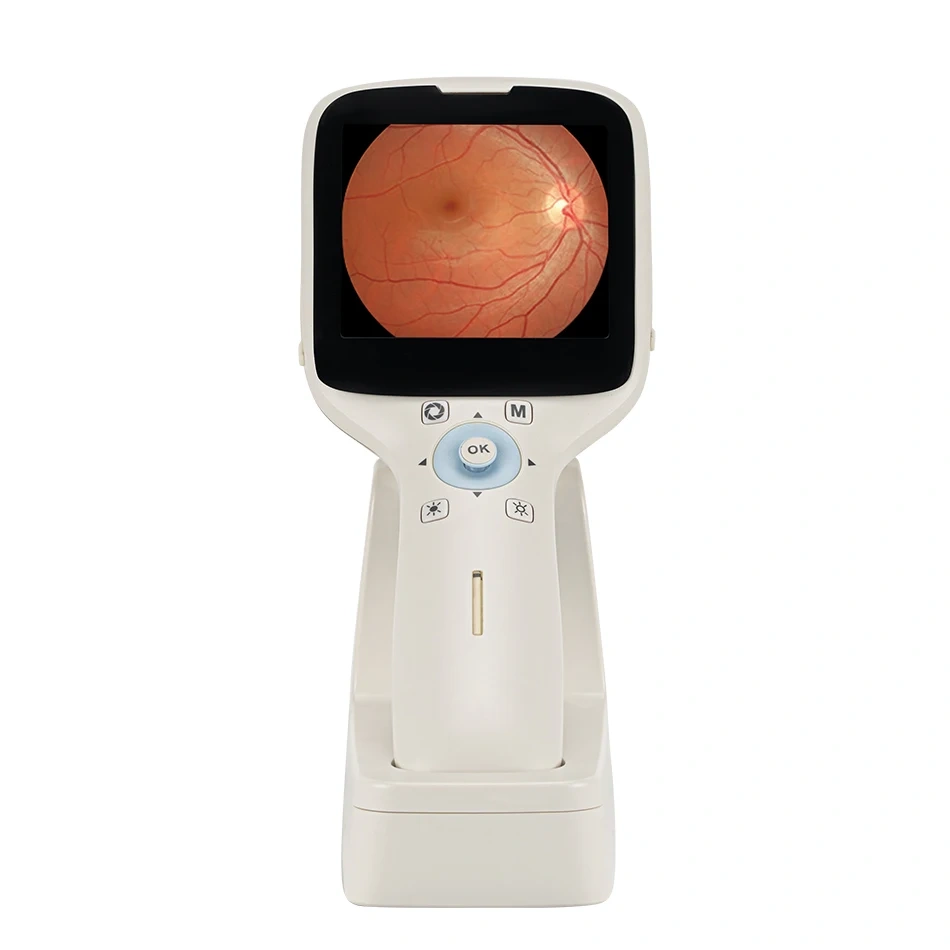 HD Ophthalmic Instrument Digital Portable Hand-held eye Fundus Camera Optics Equipment Handheld High definition Imaging HFC-1