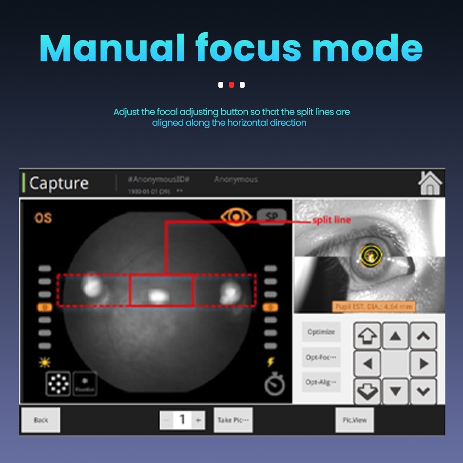 RetiCam 3100 Fundus Camera