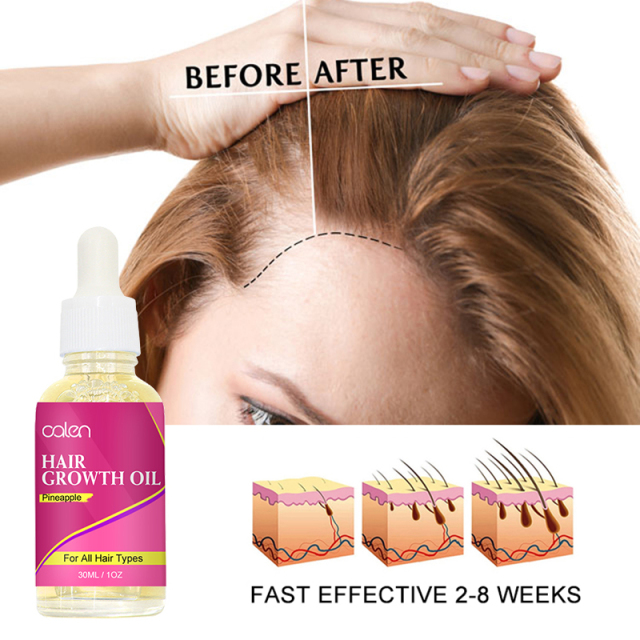 Pineapple Hair Growth Oil,oalen cosmetics