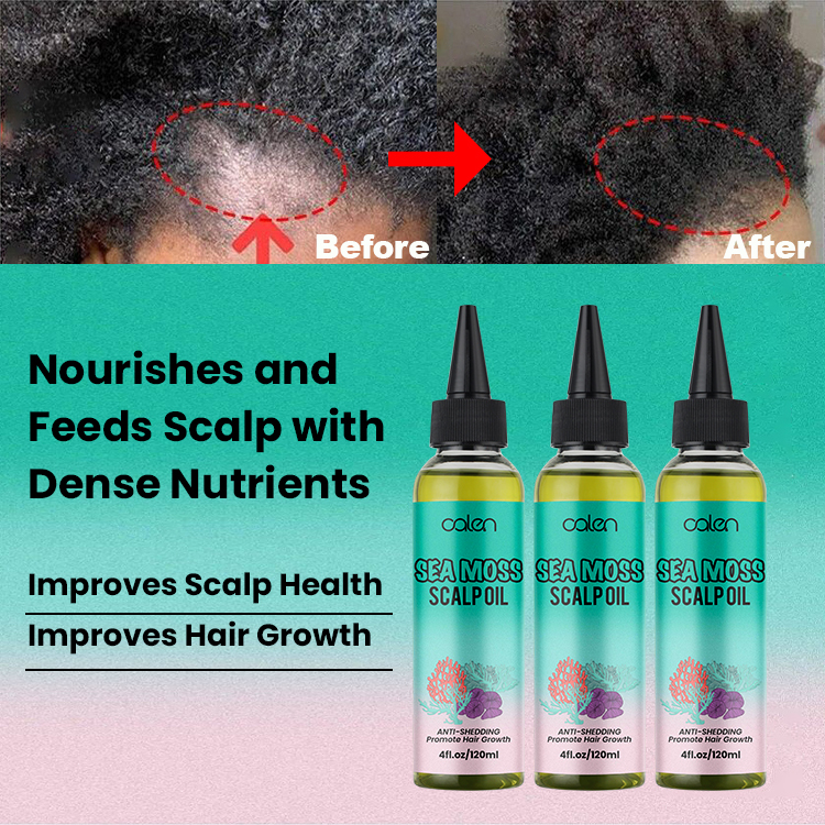 Seaweed Relieve Scalp Tension Strengthen Hair Sea Moss Scalp Oil,oalen cosmetics