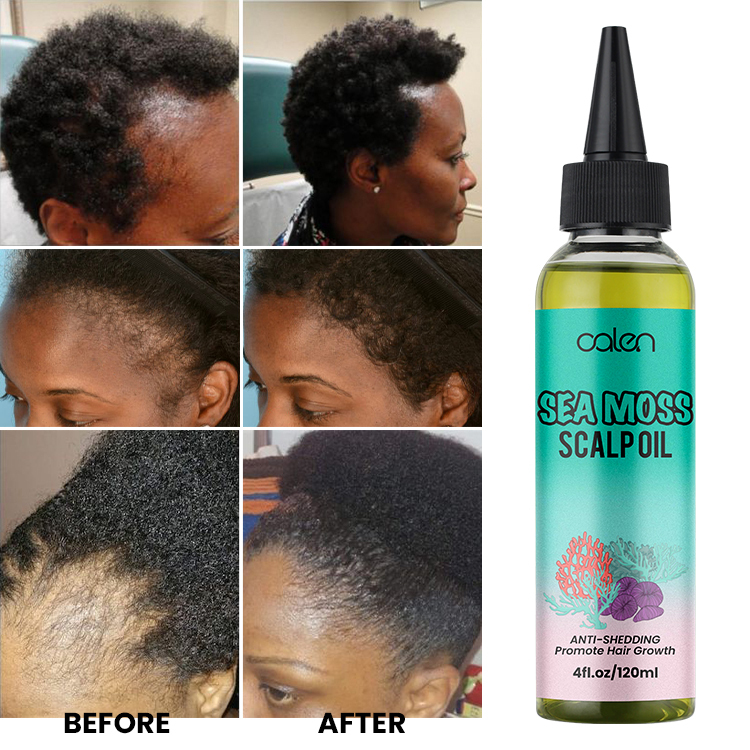 Seaweed Relieve Scalp Tension Strengthen Hair Sea Moss Scalp Oil,oalen cosmetics