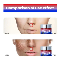 50g Skin Lifting Caviar Face Cream,oalen cosmetics