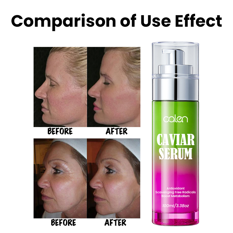 Anti Wrinkle Anti Aging Caviar Serum For Face,oalen cosmetics