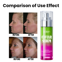 Anti Wrinkle Anti Aging Caviar Serum For Face,oalen cosmetics